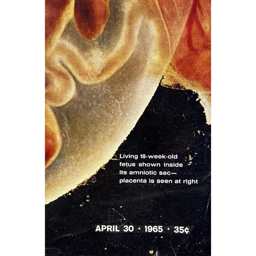 LIFE Magazine April 30, 1965 Drama Of Life Before Birth Issue - Picture 2 of 10